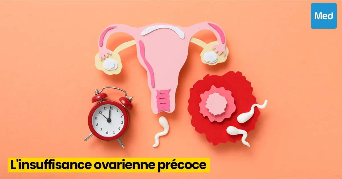 Comprendre l'Insuffisance Ovarienne Précoce : La Réserve Ovarienne Faible